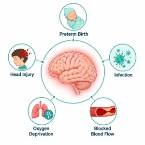 Causes of cerebral palsy - Healthcapes Haldwani